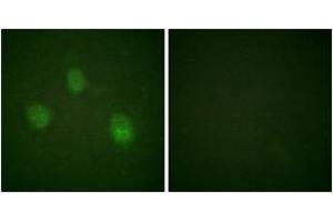 Immunofluorescence analysis of HeLa cells, using AurB (Ab-12) Antibody. (Aurora Kinase B antibody  (AA 1-50))