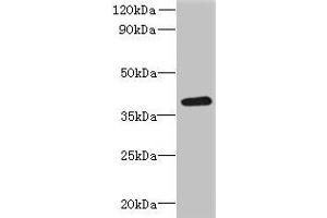 Western blot All lanes: RSPH14 antibody at 8 μg/mL + 293T whole cell lysate Secondary Goat polyclonal to rabbit IgG at 1/10000 dilution Predicted band size: 39 kDa Observed band size: 39 kDa
