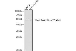 Western blot analysis of extracts of various cell lines, using PP2A-B55α/PR55α/PPP2R2A antibody (ABIN3023153, ABIN3023154, ABIN3023155 and ABIN6219415) at 1:1000 dilution. (PPP2R2A antibody  (AA 1-447))
