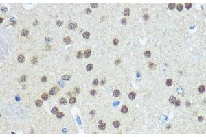 Immunohistochemistry of paraffin-embedded Mouse brain using UBA1 Polyclonal Antibody at dilution of 1:100 (40x lens). (UBA1 antibody)