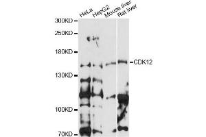 Western blot analysis of extracts of various cell lines, using CDK12 antibody (ABIN6291897) at 1:1000 dilution. (CDK12 antibody)