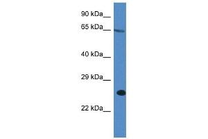 Western Blot showing ITPRIP antibody used at a concentration of 1 ug/ml against A549 Cell Lysate (ITPRIP antibody  (C-Term))