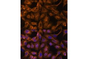 Immunofluorescence analysis of U-2 OS cells using 43713 antibody (ABIN6128759, ABIN6147556, ABIN6147557 and ABIN6216776) at dilution of 1:100. (Septin 5 antibody  (AA 1-369))