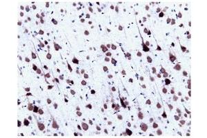 Immunohistochemistry (IHC) image for anti-Small Nuclear Ribonucleoprotein Polypeptide N (SNRPN) (AA 14-174) antibody (ABIN968086) (SNRPN antibody  (AA 14-174))