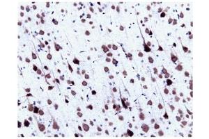 Immunohistochemistry (IHC) image for anti-Small Nuclear Ribonucleoprotein Polypeptide N (SNRPN) (AA 14-174) antibody (ABIN968086) (SNRPN antibody  (AA 14-174))