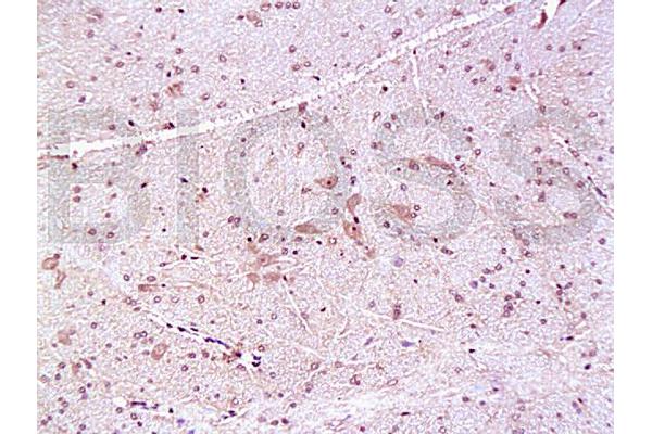 PMP22 antibody  (AA 101-160)