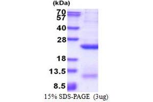 SDS-PAGE (SDS) image for Glypican 4 (GPC4) (AA 401-529) protein (His tag) (ABIN5853620) (GPC4 Protein (AA 401-529) (His tag))