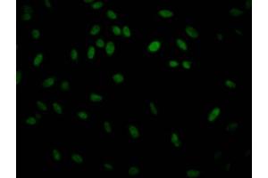 Immunofluorescence staining of Hela Cells with ABIN7127566 at 1:50, counter-stained with DAPI. (Recombinant IKBKB antibody)