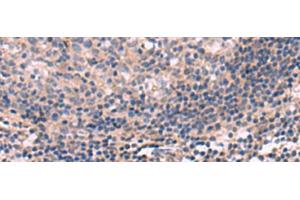 Immunohistochemistry of paraffin-embedded Human tonsil tissue using KCNT1 Polyclonal Antibody at dilution of 1:30(x200) (KCNT1 antibody)