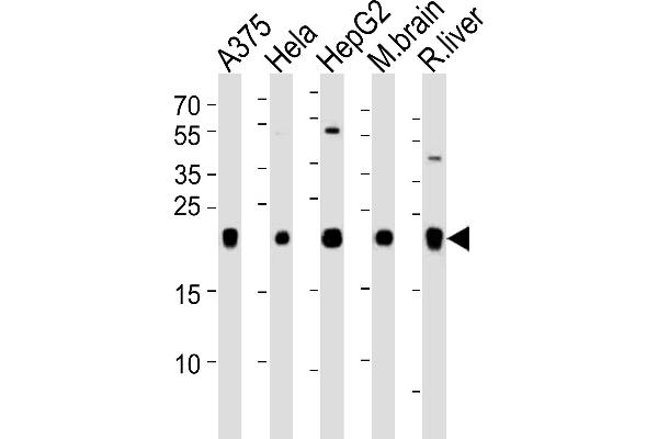 ITPA antibody  (N-Term)