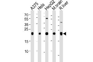 Western blot analysis of lysates from , Hela, HepG2 cell line, mouse brain and rat liver tissue lysate(from left to right), using IT Antibody (N-term) (ABIN651135 and ABIN2840091).