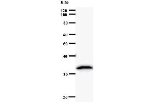Western Blotting (WB) image for anti-Caspase Recruitment Domain Family, Member 8 (CARD8) antibody (ABIN930979) (CARD8 antibody)