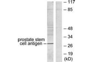 Western blot analysis of extracts from HepG2 cells, using Prostate Stem Cell Antigen Antibody.