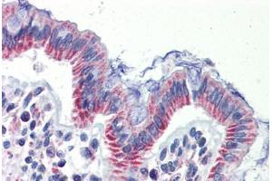 Human Colon (formalin-fixed, paraffin-embedded) stained with IMPDH1 antibody ABIN462258 followed by biotinylated goat anti-rabbit IgG secondary antibody ABIN481713, alkaline phosphatase-streptavidin and chromogen. (IMPDH1 antibody  (AA 254-303))