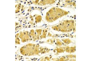 Immunohistochemistry of paraffin-embedded Human gastric using PRKAA1 antibody at dilution of 1:100 (x400 lens). (PRKAA1 antibody  (AA 1-300))