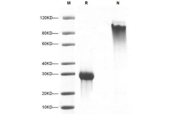 NOG Protein (AA 20-232)