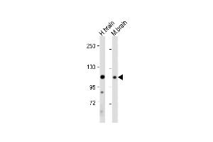 All lanes : Anti-EphA4 Antibody (C-term) at 1:2000 dilution Lane 1: Human brain tissue lysate Lane 2: Mouse brain tissue lysate Lysates/proteins at 20 μg per lane. (EPH Receptor A4 antibody  (C-Term))