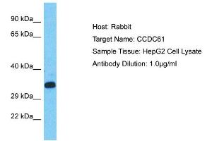 Host: Rabbit Target Name: CCDC61 Sample Type: HepG2 Whole Cell lysates Antibody Dilution: 1. (CCDC61 antibody  (C-Term))
