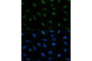 Immunofluorescence analysis of U-2 OS cells using CENPA Polyclonal Antibody (ABIN7266271) at dilution of 1:100 (40x lens). (CENPA antibody  (AA 1-100))