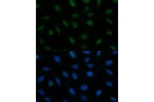 Immunofluorescence analysis of U-2 OS cells using CENPA Polyclonal Antibody (ABIN7266271) at dilution of 1:100 (40x lens). (CENPA antibody  (AA 1-100))