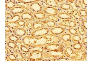 Immunohistochemistry of paraffin-embedded human kidney tissue using ABIN7170023 at dilution of 1:100 (SLC9A1 antibody  (AA 36-102))