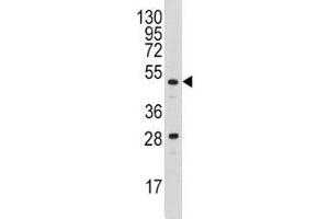 Western blot analysis of Urokinase antibody and A2058 lysate (PLAU antibody  (AA 60-90))