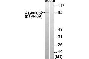 Western blot analysis of extracts from COS cells, treated with UV (15mins), using Catenin- beta (Phospho-Tyr489) antibody. (beta Catenin antibody  (pTyr489))