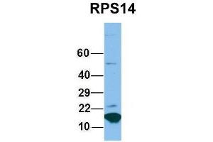 Host:  Rabbit  Target Name:  RPS14  Sample Type:  Hela  Antibody Dilution:  1. (RPS14 antibody  (Middle Region))
