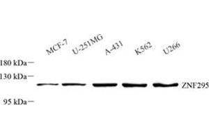 Western blot analysis of ZNF295 (ABIN7076264) at dilution of 1: 500