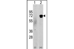 Western blot analysis of CKK2 (arrow) using rabbit polyclonal CKK2 Antibody (N-term G67) (ABIN391182 and ABIN2841279). (CAMKK2 antibody  (N-Term))