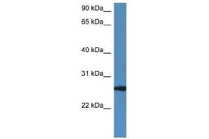 Western Blot showing Rab27b antibody used at a concentration of 1. (RAB27B antibody  (C-Term))