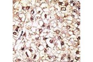 Immunohistochemistry (IHC) image for anti-Parkinson Protein 2, E3 Ubiquitin Protein Ligase (Parkin) (PARK2) (AA 387-417) antibody (ABIN3032156)
