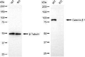 Western blotting analysis using catenin beta 1 antibody (ABIN7797932). (CTNNB1 antibody)