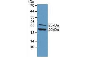 Detection of Recombinant FGF2, Mouse using Polyclonal Antibody to Fibroblast Growth Factor 2, Basic (FGF2) (FGF2 antibody  (AA 10-154))