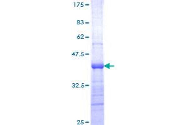 KPNA3 Protein (AA 422-521) (GST tag)