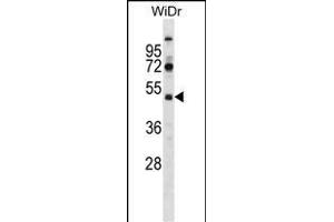 SUPT7L Antibody (Center) (ABIN1537989 and ABIN2848712) western blot analysis in WiDr cell line lysates (35 μg/lane). (SUPT7L antibody  (AA 186-214))