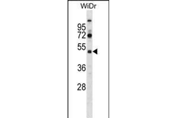 SUPT7L anticorps  (AA 186-214)