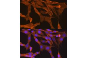 Immunofluorescence (IF) image for anti-TANK-Binding Kinase 1 (TBK1) antibody (ABIN7270723)