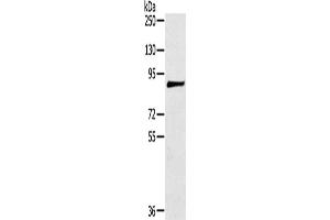 Gel: 6 % SDS-PAGE, Lysate: 40 μg, Lane: 293T cells, Primary antibody: ABIN7191356(MAGEE1 Antibody) at dilution 1/200, Secondary antibody: Goat anti rabbit IgG at 1/8000 dilution, Exposure time: 5 minutes