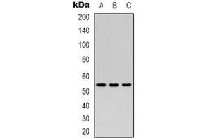 Western blot analysis of Secretogranin 3 expression in Hela (A), mouse heart (B), mouse kidney (C) whole cell lysates. (SCG3 antibody  (N-Term))