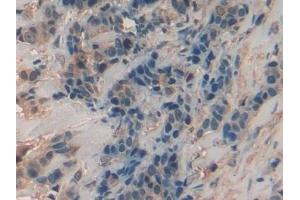 Immunohistochemistry (IHC) image for anti-Chitinase 3-Like 1 (Cartilage Glycoprotein-39) (CHI3L1) (AA 112-377) antibody (ABIN7433657)