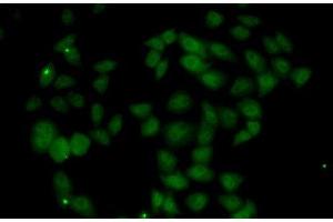 Immunofluorescence analysis of U2OS cells using FGF14 Polyclonal Antibody (FGF14 antibody)