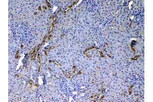 IHC analysis of EGF using anti-EGF antibody . (EGF antibody  (AA 974-1026))