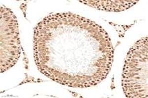 Immunohistochemistry analysis of paraffin-embedded mouse testis using,MCM4 (ABIN7074631) at dilution of 1: 2400 (MCM4 antibody)