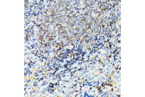 Immunohistochemistry of paraffin-embedded rat spleen using CORO1A Rabbit pAb (ABIN6133495, ABIN6138903, ABIN6138904 and ABIN6224969) at dilution of 1:100 (40x lens). (Coronin 1a antibody  (AA 362-461))