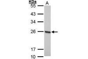 Image no. 1 for anti-Peroxiredoxin 1 (PRDX1) (AA 19-116) antibody (ABIN467365) (Peroxiredoxin 1 antibody  (AA 19-116))