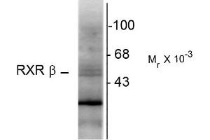 Western blots of hippocampal lysate showing specific immunolabeling of the ~48k RXR-ß protein. (Retinoid X Receptor beta antibody)