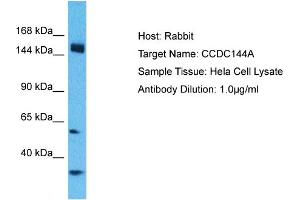 Host: Rabbit Target Name: CCDC144A Sample Type: Hela Whole cell lysates Antibody Dilution: 1. (CCDC144A antibody  (C-Term))
