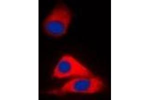 Immunofluorescent analysis of MVK staining in HepG2 cells. (MVK antibody)