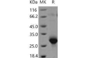 CD300LG Protein (His tag)